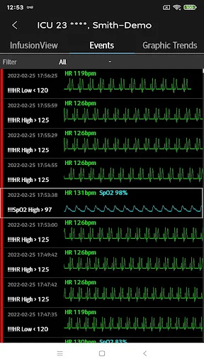 Descargar Mindray Mobile Viewer: Monitoreo Médico en Tiempo Real - Screenshot 5