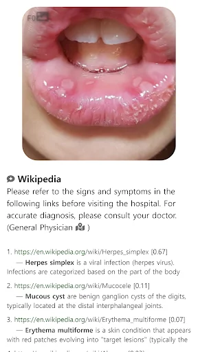 Model Dermatol: Atlas de Enfermedades de la Piel – Descarga Gratis - Screenshot 15