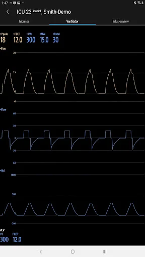 Descargar Mindray Mobile Viewer: Monitoreo Médico en Tiempo Real - Screenshot 12
