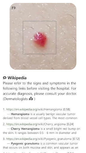 Model Dermatol: Atlas de Enfermedades de la Piel – Descarga Gratis - Screenshot 11
