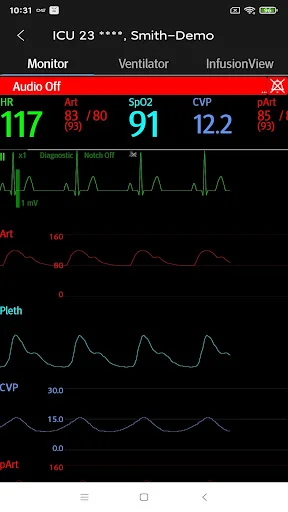 Descargar Mindray Mobile Viewer: Monitoreo Médico en Tiempo Real - Screenshot 3