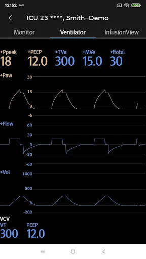 Descargar Mindray Mobile Viewer: Monitoreo Médico en Tiempo Real - Screenshot 4