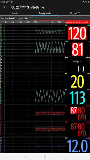 Descargar Mindray Mobile Viewer: Monitoreo Médico en Tiempo Real - Screenshot 23