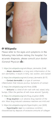 Model Dermatol: Atlas de Enfermedades de la Piel – Descarga Gratis - Screenshot 7