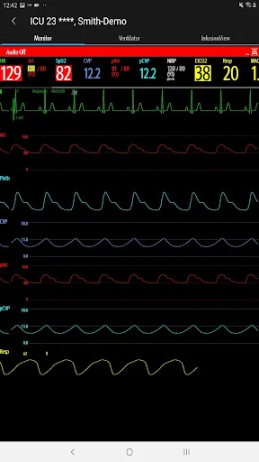Descargar Mindray Mobile Viewer: Monitoreo Médico en Tiempo Real - Screenshot 11